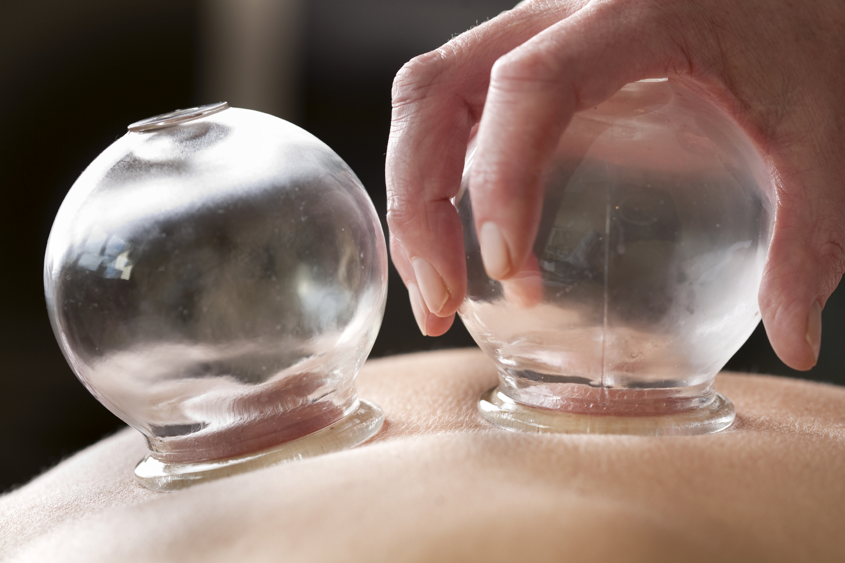 Going full circle: all about cupping